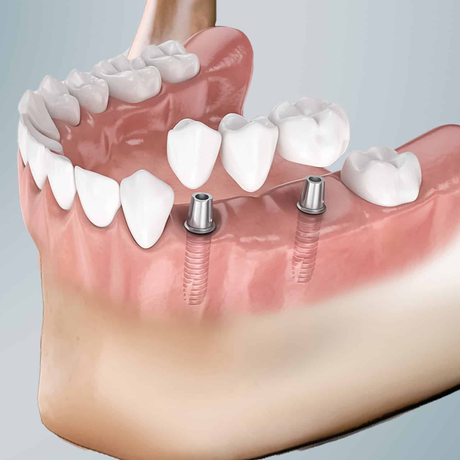 procedure